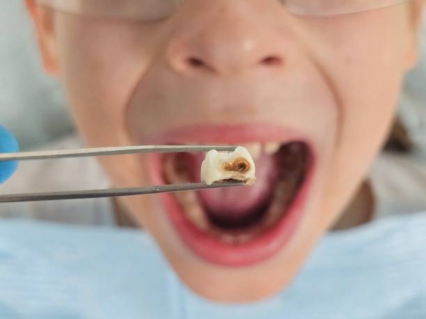 Best Emergency Denture Repair in Leonard, TX